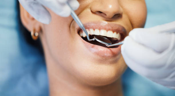 Best Emergency Broken Tooth Repair in Texarkana, TX
